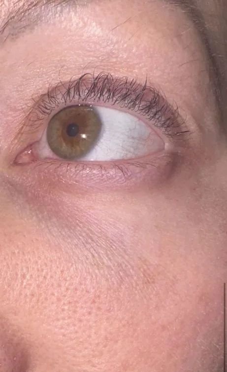 Lash detail, another angle